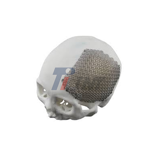 titanium plate head after brain surgery supplier